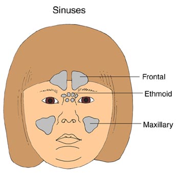 可能受鼻窦炎影响的鼻窦类型：额叶，筛和上颌。