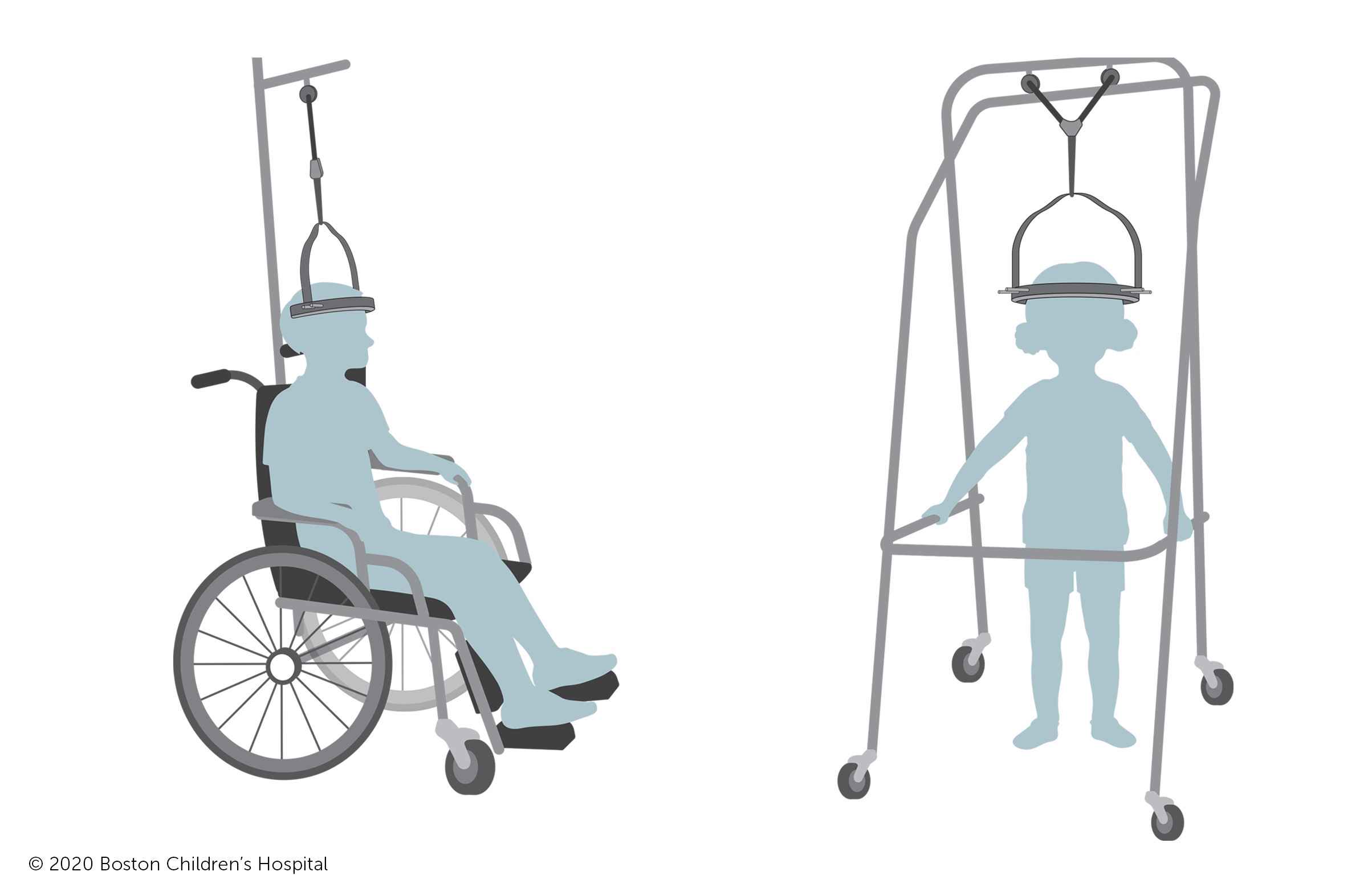 接受晕轮牵引的儿童可以乘坐特殊的轮椅和助行器在医院走动。