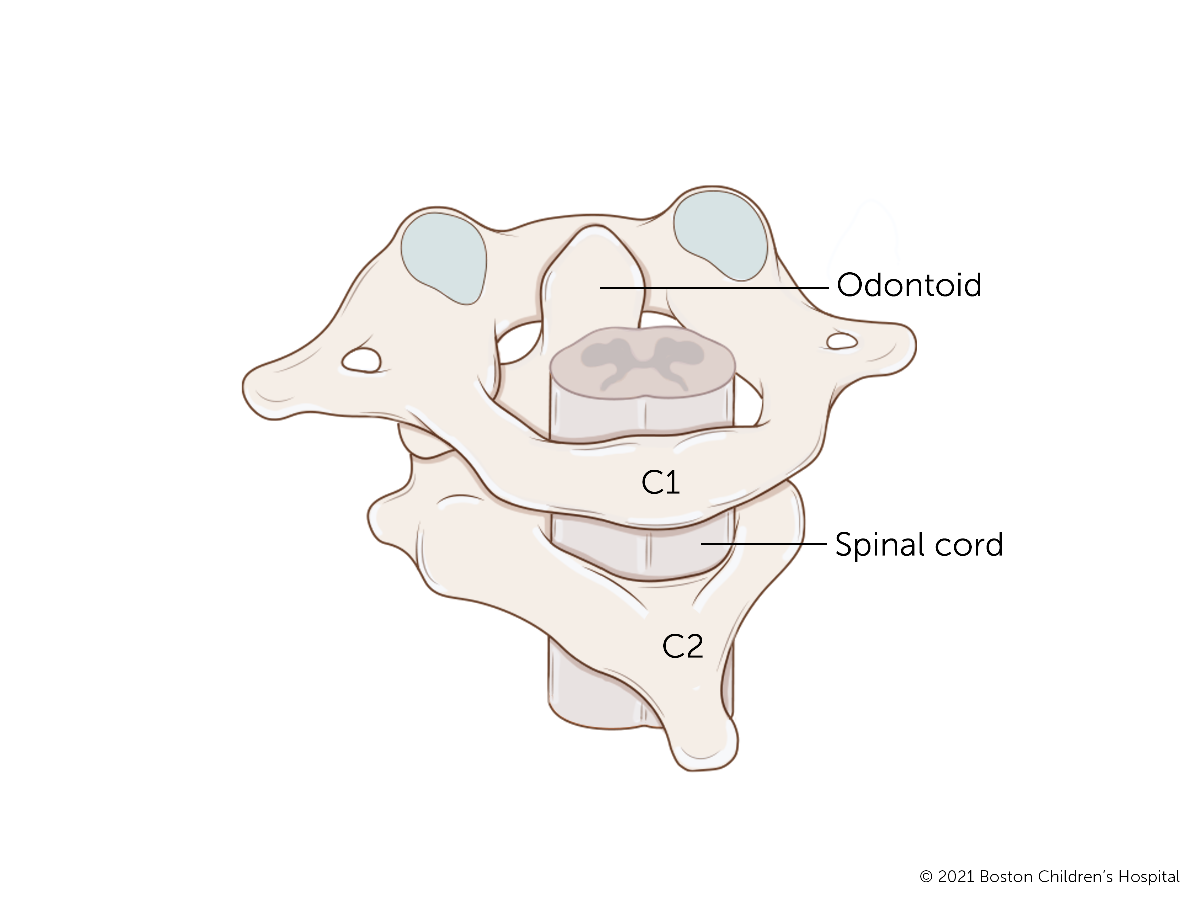 位于脊柱顶部的C1和C2椎骨由一个称为齿状突的结节连接。
