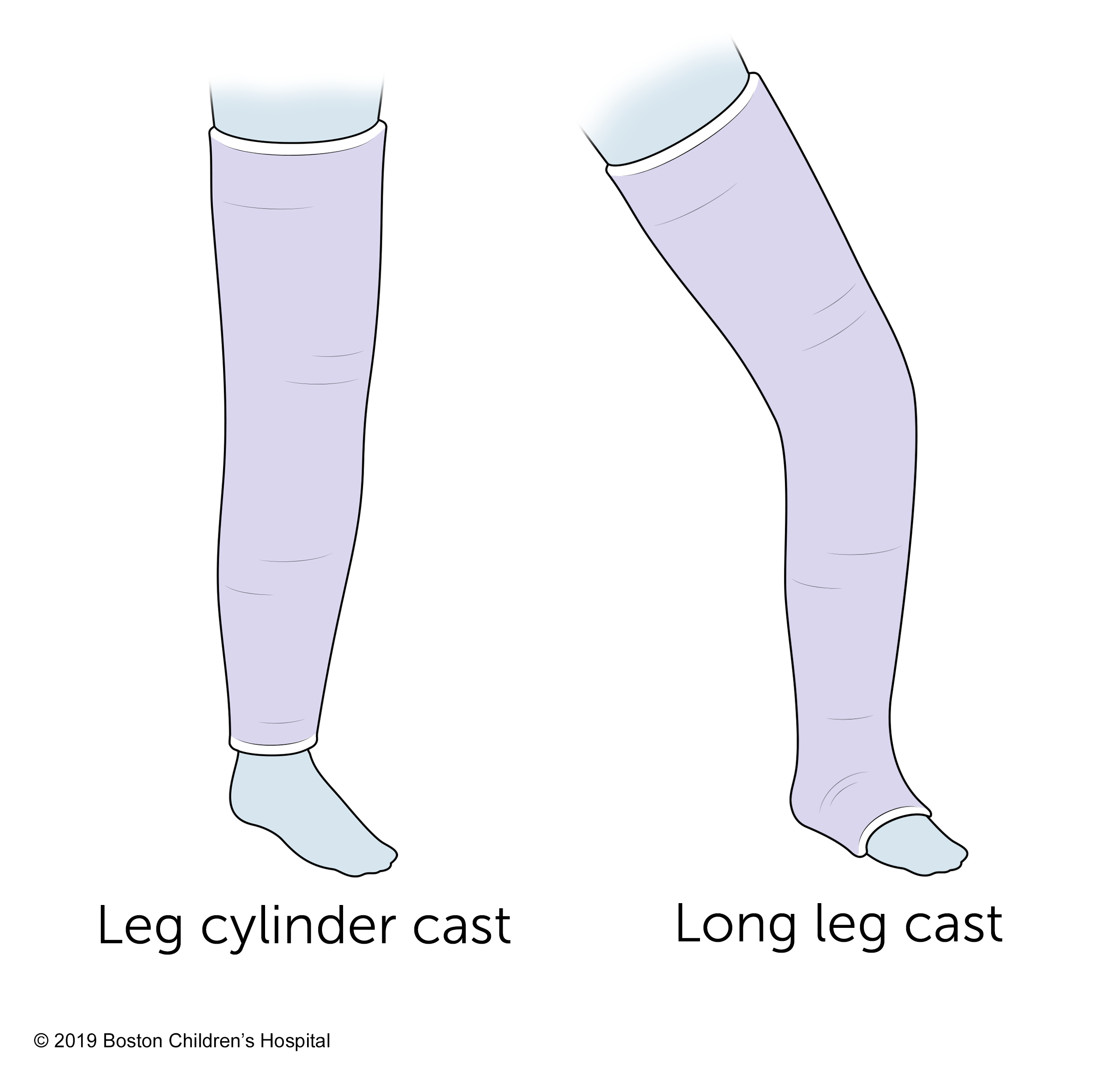 腿筒和长腿铸件